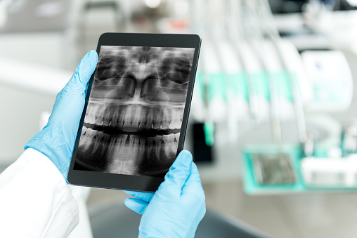 Dental technology from Dr. Hosseini in San Antonio