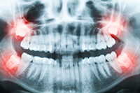 GettyImages 467995341 width of 200 pixels GettyImages 467995341 width of 200 pixels