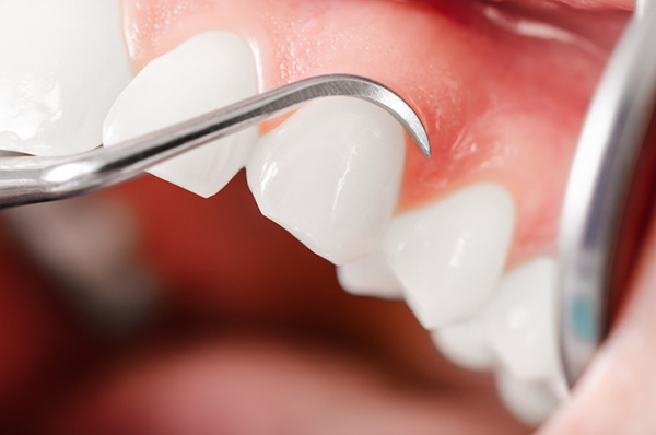 Close up of healthy gums and pearly teeth