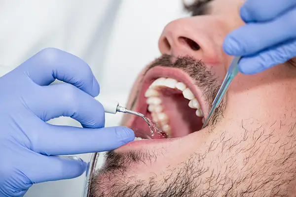 Dentist performing a periodontal cleaning procedure on a male patient using dental tools to remove plaque.